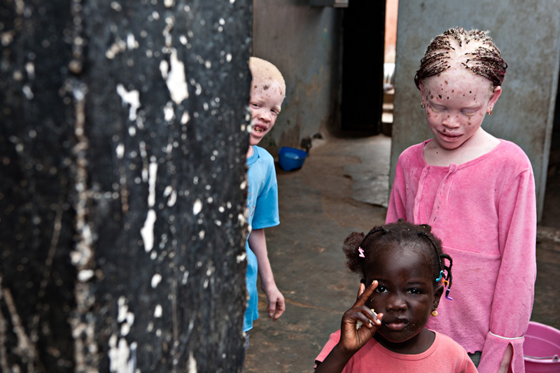 Casa África muestra la realidad de la vida de los albinos en Senegal con una exposición fotográfica