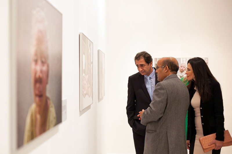 Casa África muestra la realidad de la vida de los albinos en Senegal con una exposición fotográfica