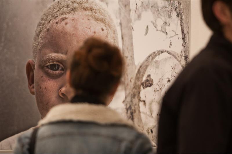 8. Exposición Albinos, a la sombra del sol, en Casa África