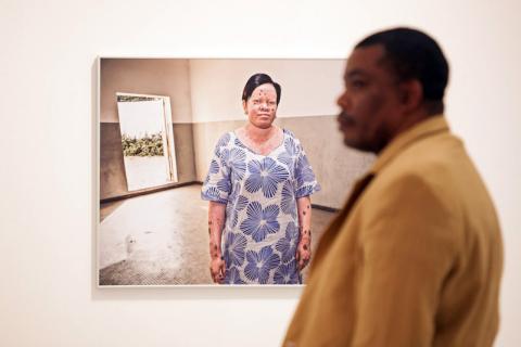 Casa África muestra la realidad de la vida de los albinos en Senegal con una exposición fotográfica