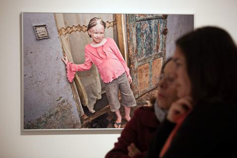 Casa África muestra la realidad de la vida de los albinos en Senegal con una exposición fotográfica