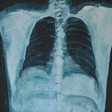 7. Imagen de Lungs, obra realizada por Conor Ralphs para la residencia artística en Hangar (Barcelona), 2012