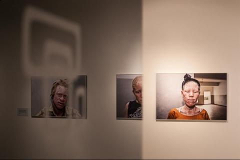 1. Exposición Albinos, a la sombra del sol, en Casa África