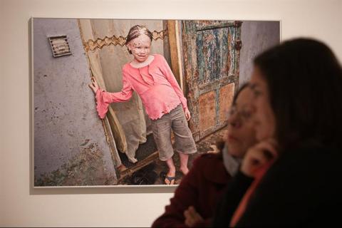 3. Exposición Albinos, a la sombra del sol, en Casa África