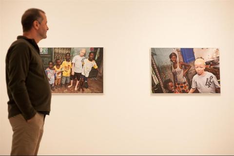 6. Exposición Albinos, a la sombra del sol, en Casa África