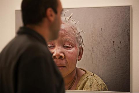 7. Exposición Albinos, a la sombra del sol, en Casa África