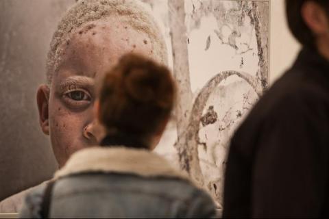 8. Exposición Albinos, a la sombra del sol, en Casa África