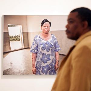 Casa África muestra la realidad de la vida de los albinos en Senegal con una exposición fotográfica