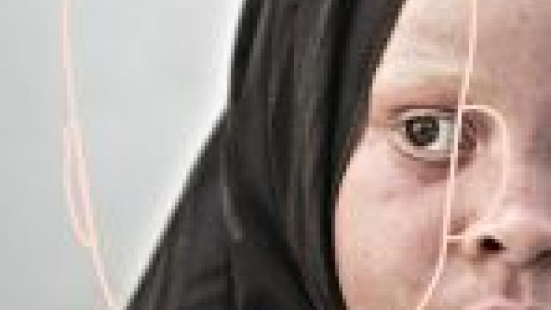 Albino, bajo la sombra del sol, Ana Yturralde