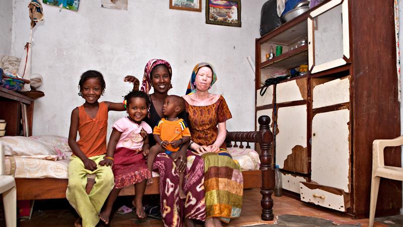 Casa África muestra la realidad de la vida de los albinos en Senegal con una exposición fotográfica