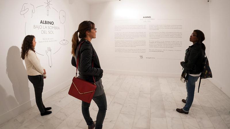 Casa África muestra la realidad de la vida de los albinos en Senegal con una exposición fotográfica