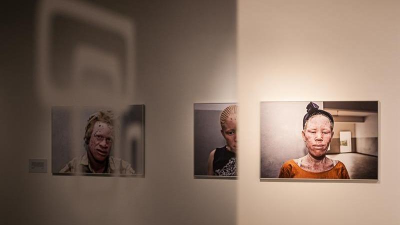 1. Exposición Albinos, a la sombra del sol, en Casa África