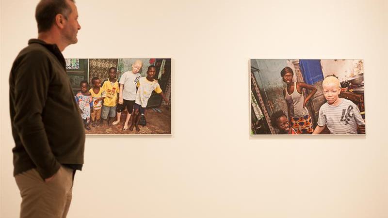 6. Exposición Albinos, a la sombra del sol, en Casa África