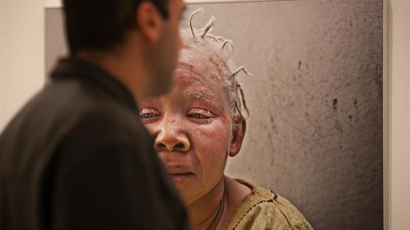 7. Exposición Albinos, a la sombra del sol, en Casa África