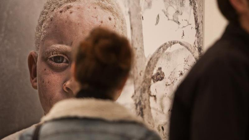 8. Exposición Albinos, a la sombra del sol, en Casa África