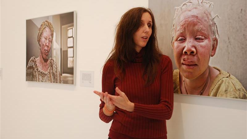 16. Imagen de la entrevista a Ana Yturralde, fotógrafa, en la exposición Albinos, a la sombra del sol en Casa África