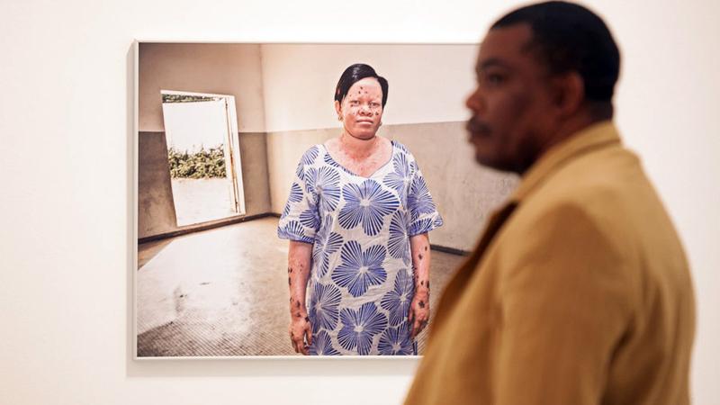 Casa África muestra la realidad de la vida de los albinos en Senegal con una exposición fotográfica